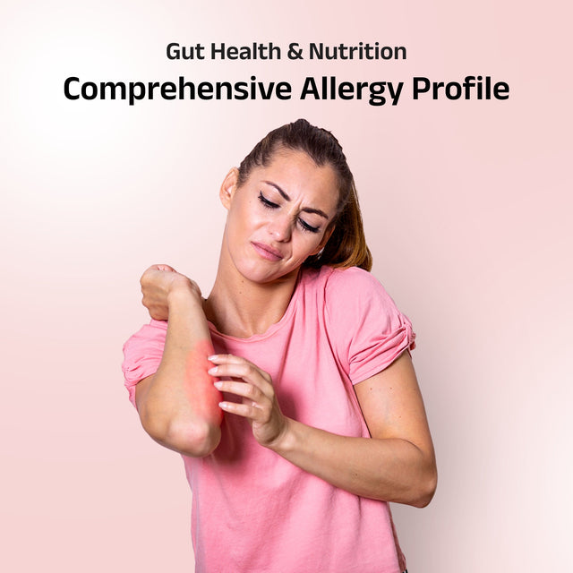 Allergy Deep Dive
